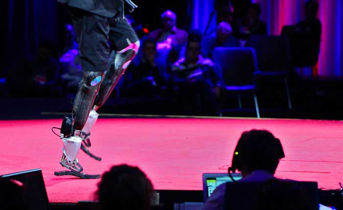 Curb prosthetic-leg cheating